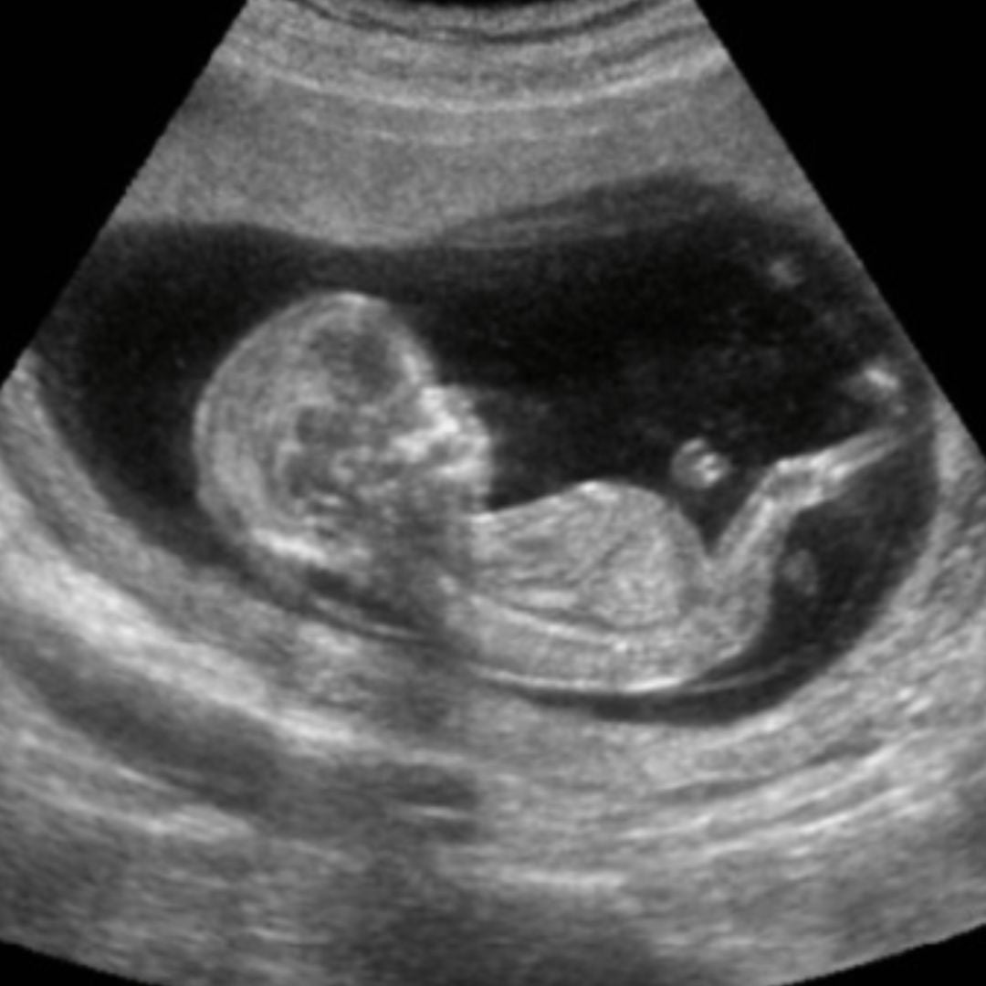 Ultrasound engraved inside the crystal lamp